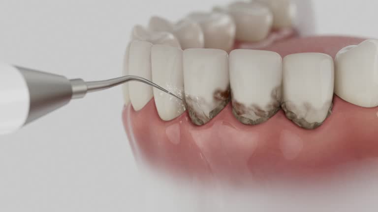 Reliable Emergency Dentist contractor in Beaumont, CA by Smile Center Dentistry